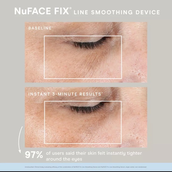 NuFACE FIX Line EYE Lips Face Smoothing Device FDA Cleared w/Starry Eyes masks - Picture 3 of 7